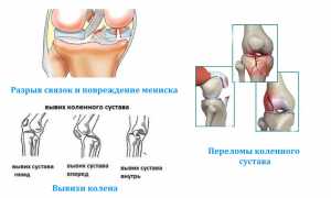 Ноющая боль в области колена в состоянии покоя: причины и лечение