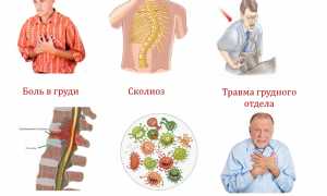 Рентгенограмма грудного отдела позвоночника: диагностика и лечение