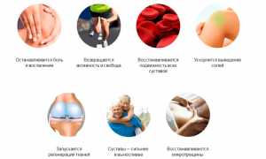 Sustalife — действенное средство при болезнях суставов для улучшения качества жизни