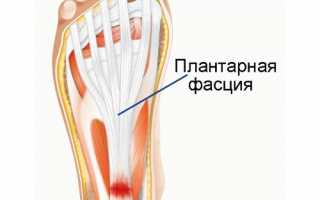 Эффективное лечение пяточной шпоры массажем для здоровья