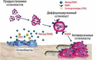 Пролиа — эффективный препарат для лечения остеопороза у женщин