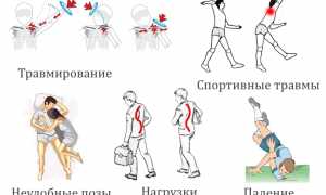 Появление болей в плече при поднятии руки вверх: причины и рекомендации