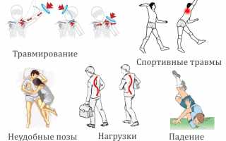Появление болей в плече при поднятии руки вверх: причины и рекомендации