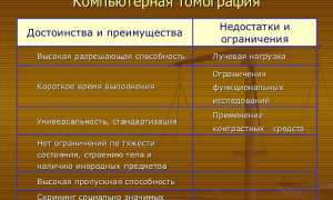 Проведение компьютерной томографии коленного сустава для диагностики заболеваний