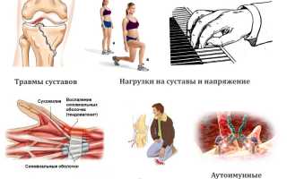 Причины развития сухожильного ганглия и его лечение: важные аспекты