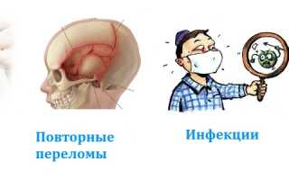 Как лечить фиброзную дисплазию костей черепа? Полезные советы и рекомендации