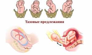 Как лечить смещение позвонков шейного отдела? Полезные советы и рекомендации.