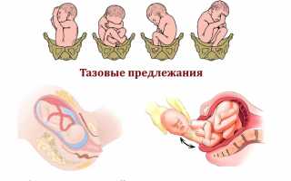 Как лечить смещение позвонков шейного отдела? Полезные советы и рекомендации.
