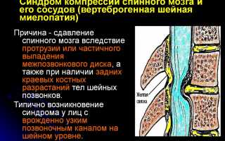 Диагностика и лечение при диагнозе цервикалгия шеи: важные аспекты