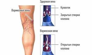 Почему возникают судороги в ногах и как с ними бороться? Полезные советы и рекомендации