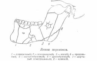 Первая помощь при переломе челюсти и особенности лечения в домашних условиях