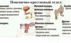 Причины болей в пояснице во время и после секса: важные аспекты