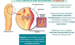 Эффективность применения трав для лечения подагры и улучшения здоровья