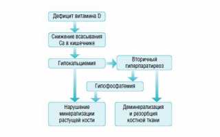 Возможные причины артропатии, ее симптоматика и лечение: важные аспекты для понимания