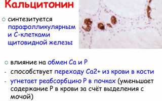 Препарат Кальцитрин при заболеваниях костной ткани: применение и эффективность
