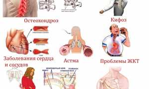 Как снять боли в спине в грудном отделе позвоночника? Полезные советы и рекомендации.