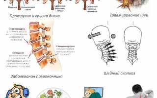 Симптомы радикулопатии шейного отдела позвоночника С5-С6: причины и лечение