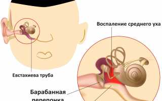 Можно ли заразиться отитом от другого