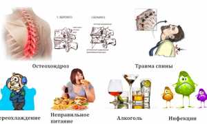 Какую мазь использовать при лечении невралгии? Полезные советы и рекомендации