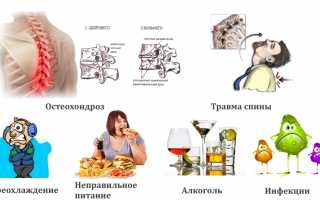 Какую мазь использовать при лечении невралгии? Полезные советы и рекомендации