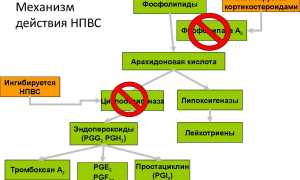 Противовоспалительные средства (НПВС) при болях в суставах: обзор и рекомендации