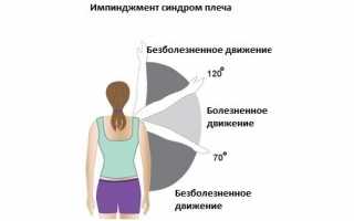 Проявление импинджмент синдрома плеча и его лечение: причины и методы