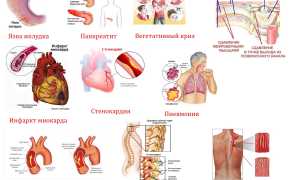 Почему может болеть под лопаткой слева сзади? Причины и советы