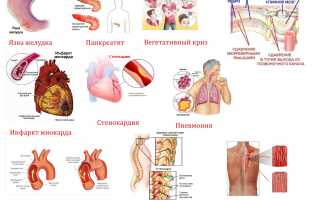 Почему может болеть под лопаткой слева сзади? Причины и советы