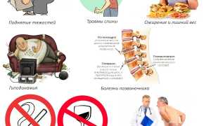 Применение миорелаксантов при грыже поясничного отдела: особенности и рекомендации