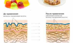 Как правильно применять желатин для лечения суставов и улучшения здоровья?
