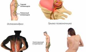 Правильное использование качелей Яловицына для отдыха и развлечений