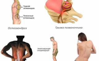 Правильное использование качелей Яловицына для отдыха и развлечений
