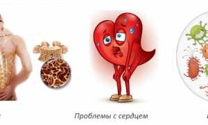 Когда нужно принимать лекарственное средство Кальцид для здоровья?