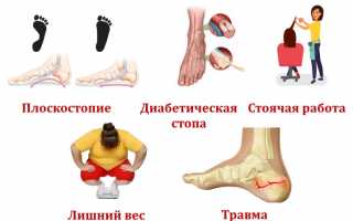 Признаки развития кисты пяточной кости и ее лечение: важные аспекты