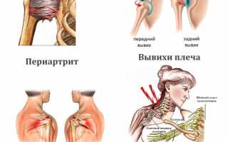 Проведение артроскопии плечевого сустава и восстановление после операции: важные аспекты и рекомендации