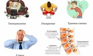 Меры помощи и профилактики при болях внизу спины для улучшения качества жизни