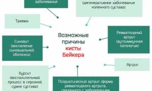 Почему появляется гигрома колена и как ее лечить? Полезные советы