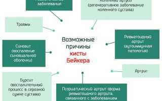 Почему появляется гигрома колена и как ее лечить? Полезные советы