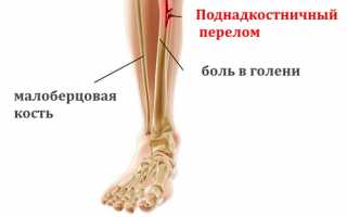 Лечение при переломе по типу зеленой веточки у детей: советы и рекомендации