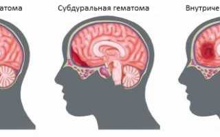 Симптомы и лечение ушиба мягких тканей головы: важные аспекты