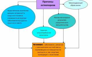 Симптомы и лечение остеопороза тазобедренного сустава: важные аспекты здоровья