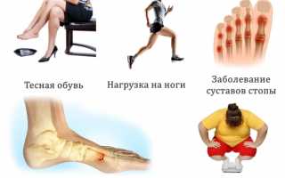 Опасно ли развитие гигромы стопы и чем ее лечить? Узнайте больше о последствиях