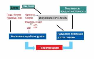 Как быстро снять острую боль при подагре во время приступа? Полезные советы и рекомендации