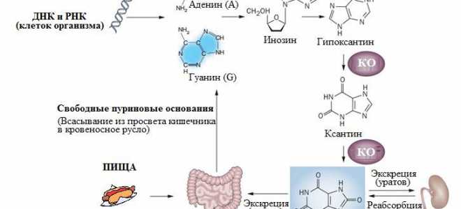 Проводим очищение суставов с помощью лаврового листа для здоровья