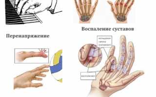 Признаки и методы устранения гигромы на пальце руки: полезные советы