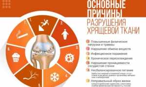 Препарат Хондромикс при заболеваниях суставов: эффективное решение для здоровья