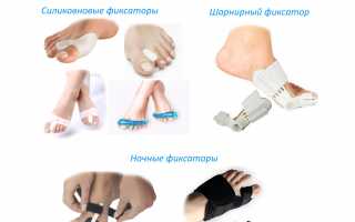 Ортопедический фиксатор для коррекции косточек на ногах: эффективное решение проблемы