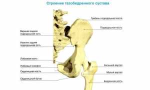 Симптомы дисплазии тазобедренных суставов и ее лечение: важные аспекты и рекомендации