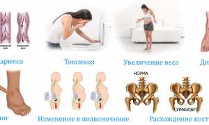 Почему возникает онемение ног при беременности и что с этим делать?