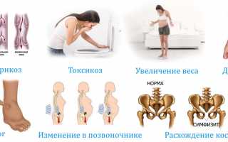 Почему возникает онемение ног при беременности и что с этим делать?